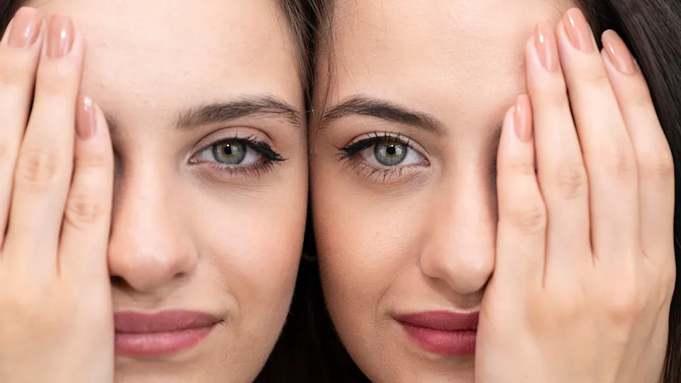 Canthal Tilt: What It Is and Why It Matters