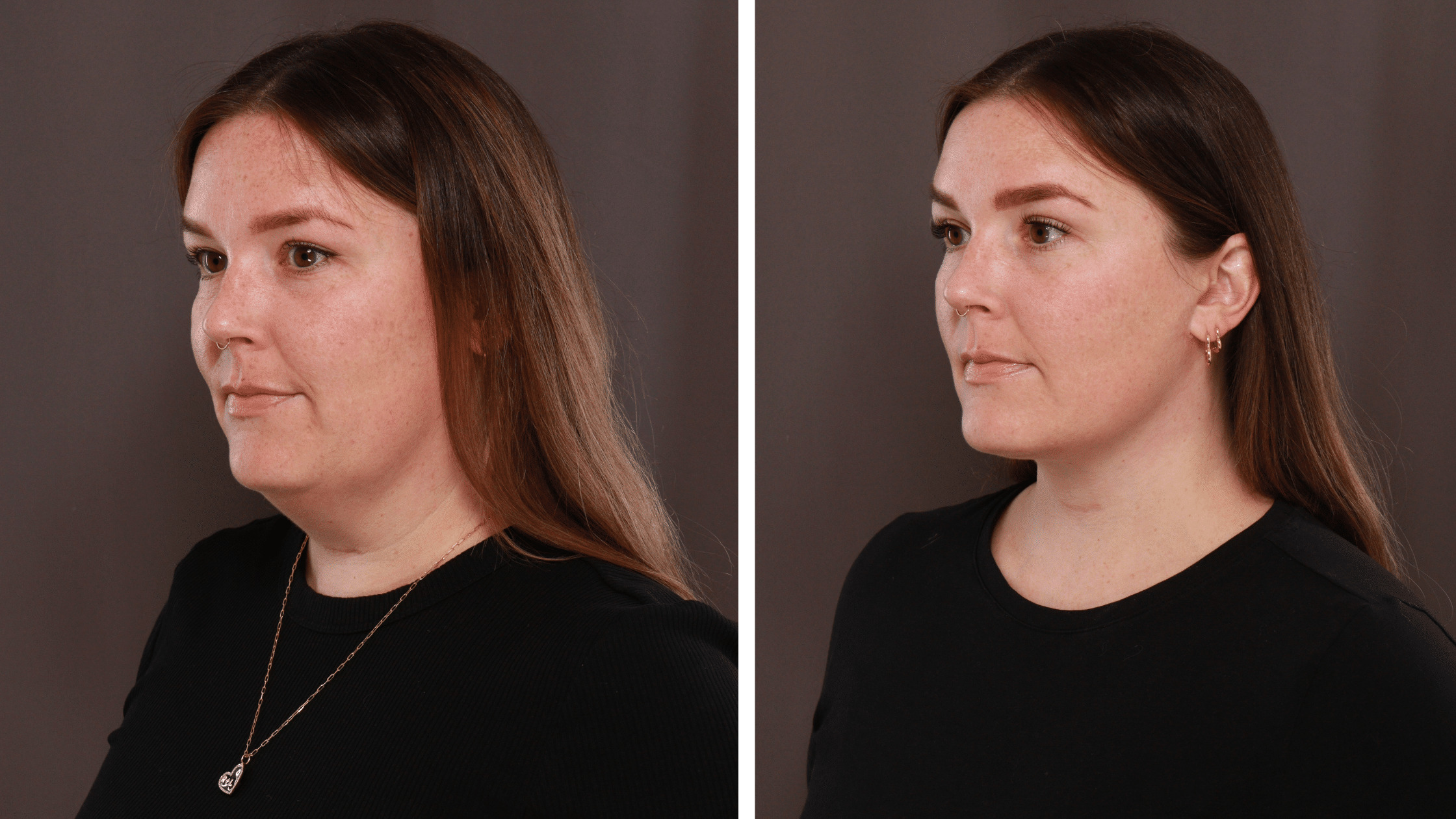 How to Get a More Defined Jawline